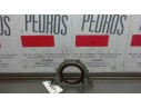 RETEN CIGUEÑAL DERECHO 